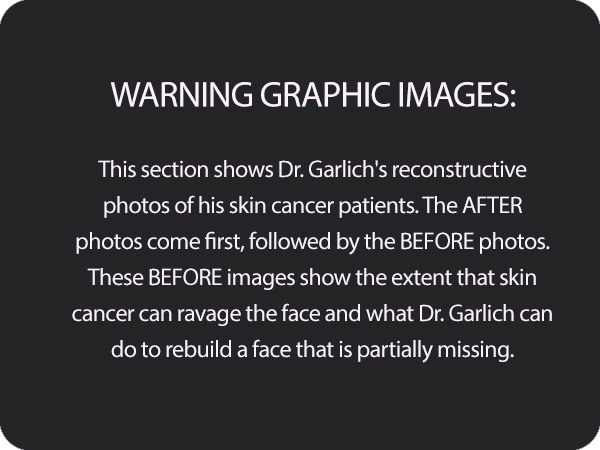 Warning: Graphic Images