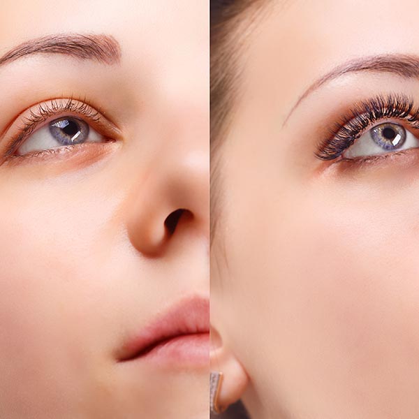 Before and after of a lash extension patient.