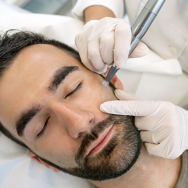 Doctor giving a man a non-surgical SkinTyte treatment.
