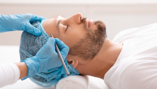 Handsome man getting pencil marks on forehead before facial surgery. Plastic surgeon applying marks on man face before surgery at aesthetic clinic, side view.